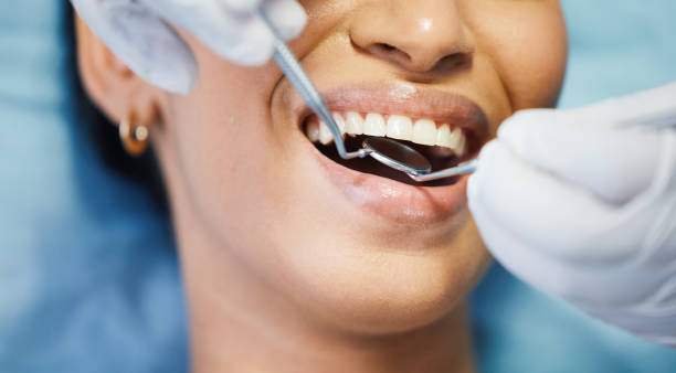 Best Emergency Treatment for Toothache in Cascade Chipita Park, CO