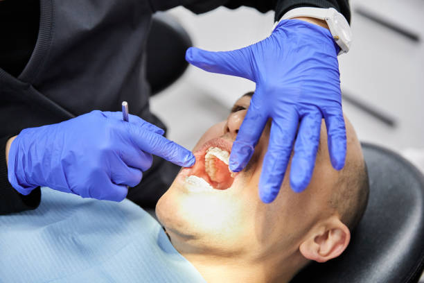 Best Emergency Root Canal Treatment in Cascade Chipita Park, CO