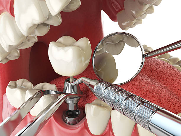 Best Emergency Dental Surgery in Cascade Chipita Park, CO